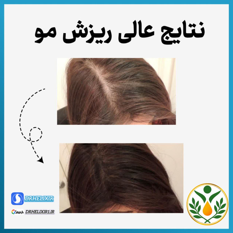 روغن ضد ریزش مو و رویش مجدد هلکسیر