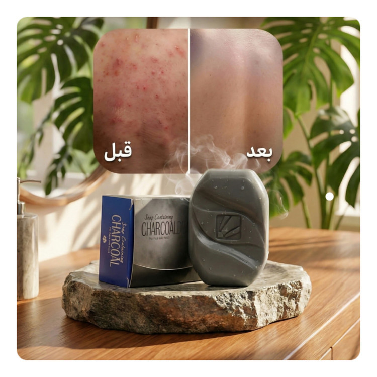 صابون کربن سیاه (کربن اکتیو) بیز ضدجوش، ضد لک و لایه بردار پوست